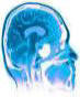 Brain Diagram - Hypnotherapy Register